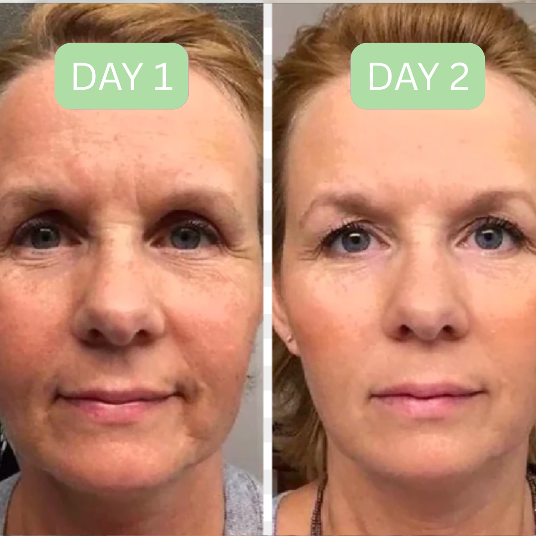 Lymphatic Drainage Brush