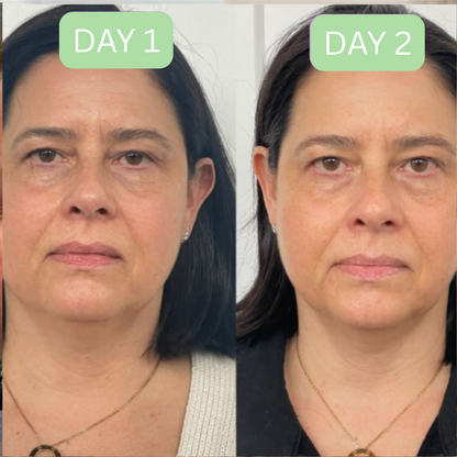 Lymphatic Drainage Brush